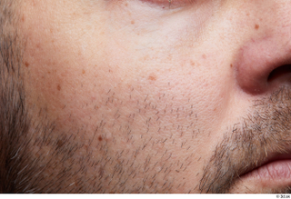  HD Face Skin Raul Conley cheek face skin pores skin texture 0003.jpg